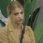 Milica Kemez skinula zavoje i pokazala novo lice, koje je koštalo 3000 evra