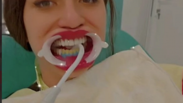 Miljana Kulić kod zubara