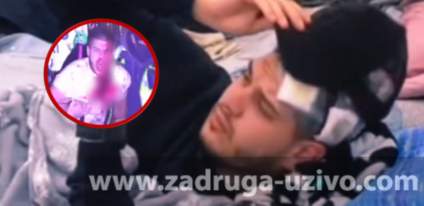 PRETE MU OZBILJNE ZDRAVSTVENE KOMPLIKACIJE?! Isplivao jeziv snimak Dejana koji vadi staklo iz glave, gledaoci zabrinuti! (VIDEO)